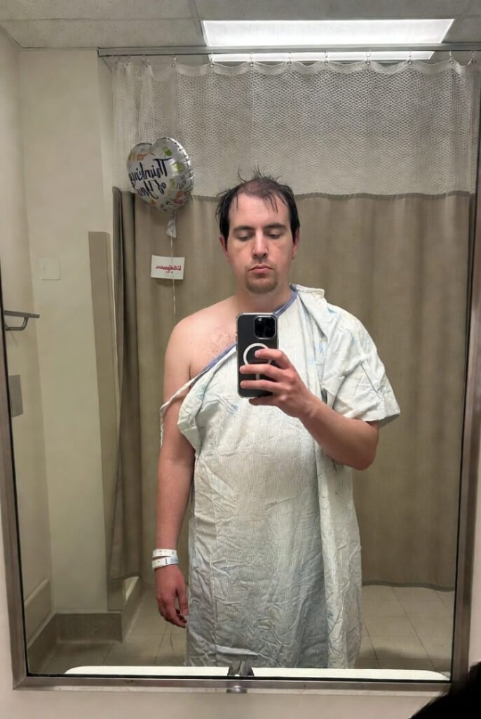 Tired half-grin in hospital paper gown